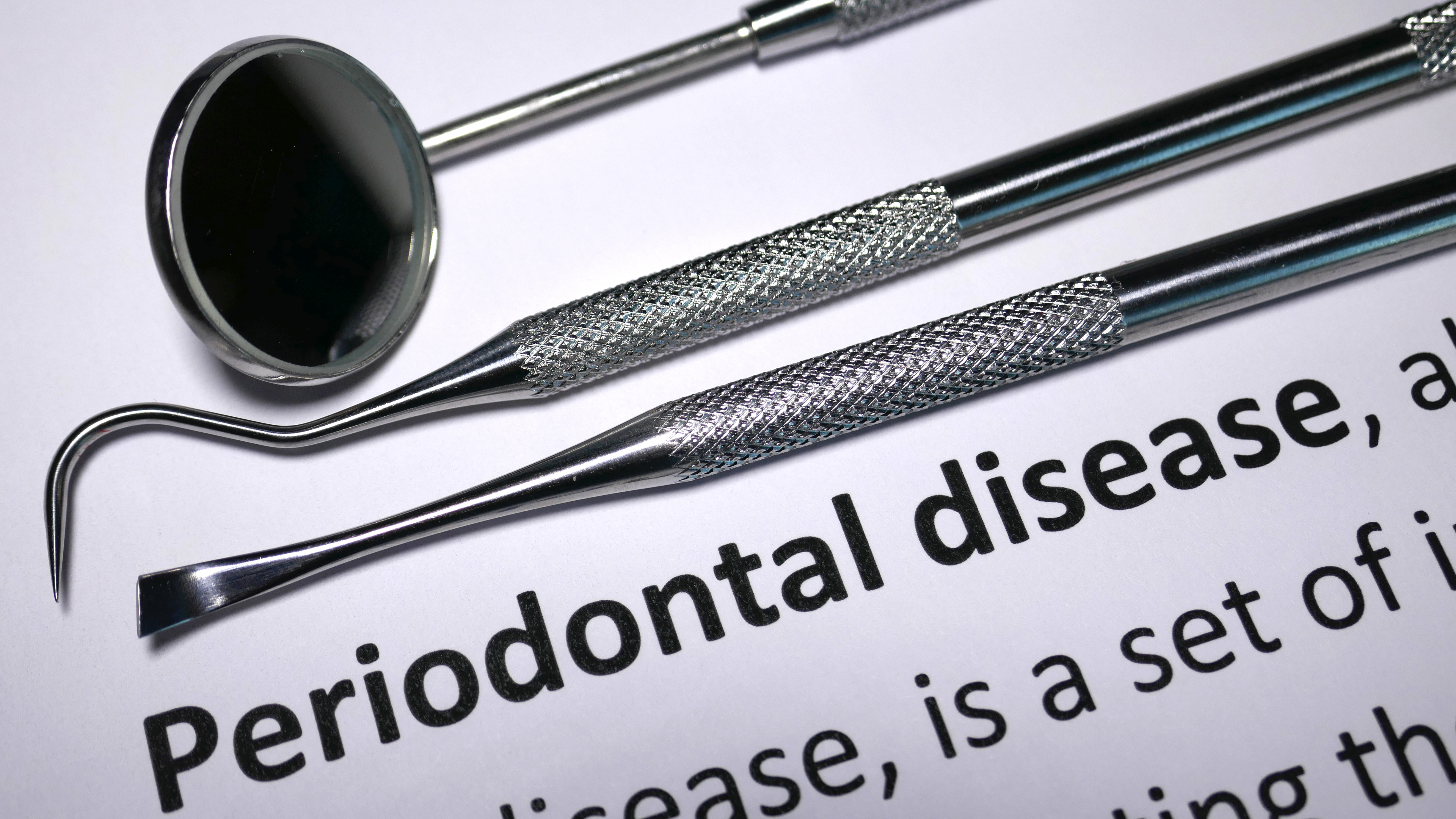 Per Quanto Tempo Puoi Ignorare la Malattia Parodontale?