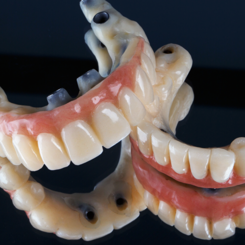 I benefici del trattamento all-on-4