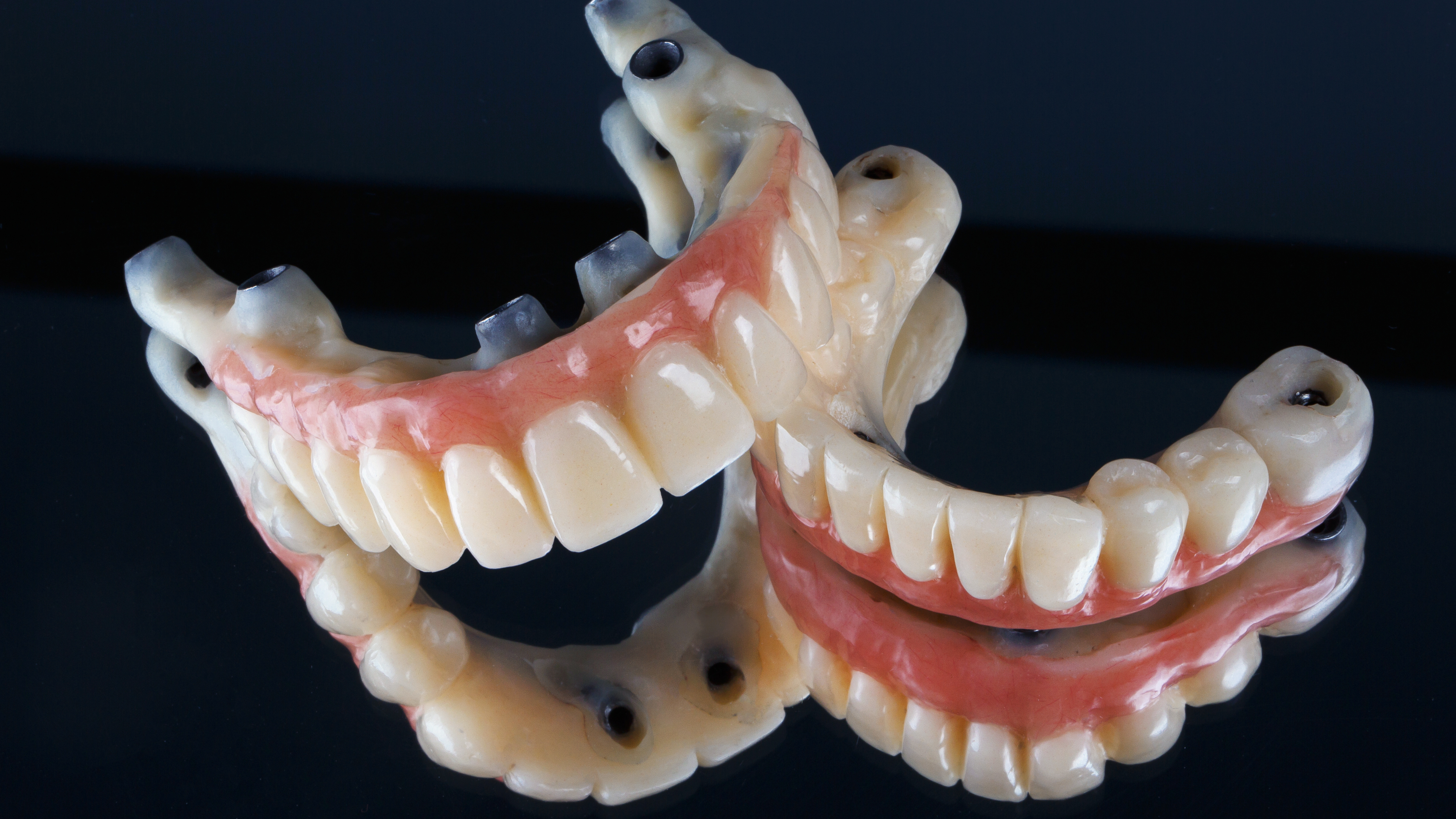 I benefici del trattamento All-On-4